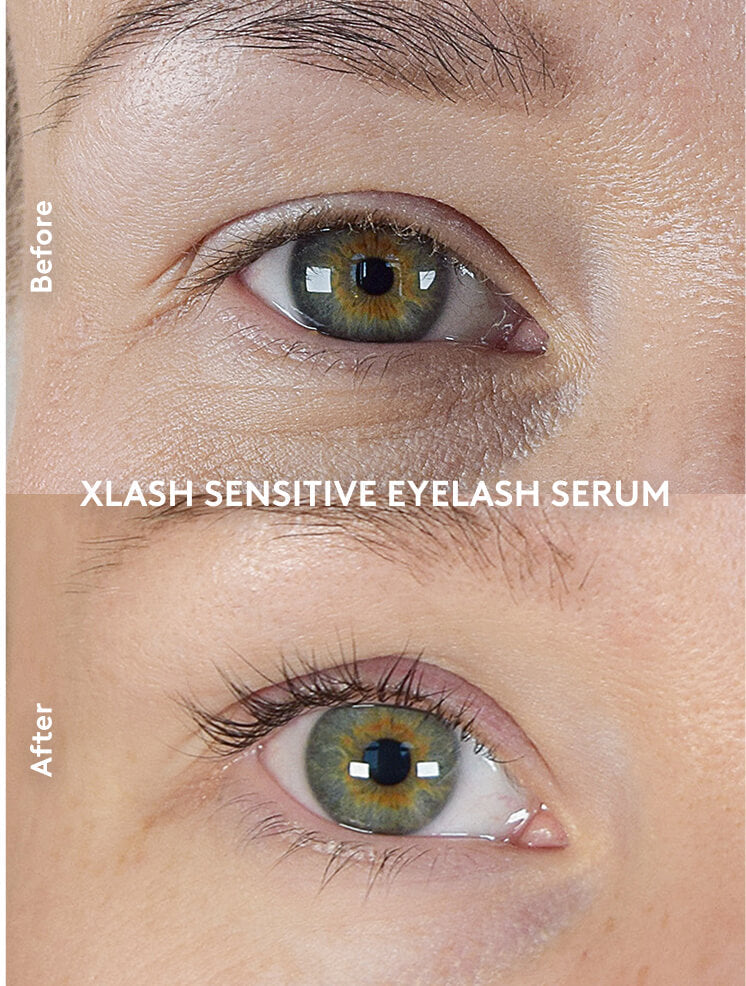 Xlash Sensitive Eyelash Serum 3ml
