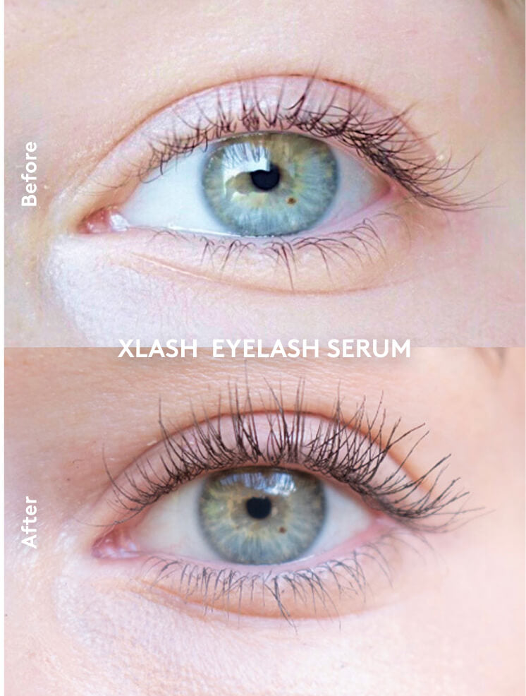 Xlash Eyelash Serum  1ml