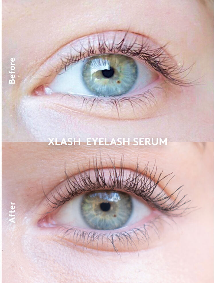Xlash Eyelash serum 3ml